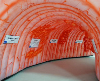 Photo of Texas Health Resources' walk through colon